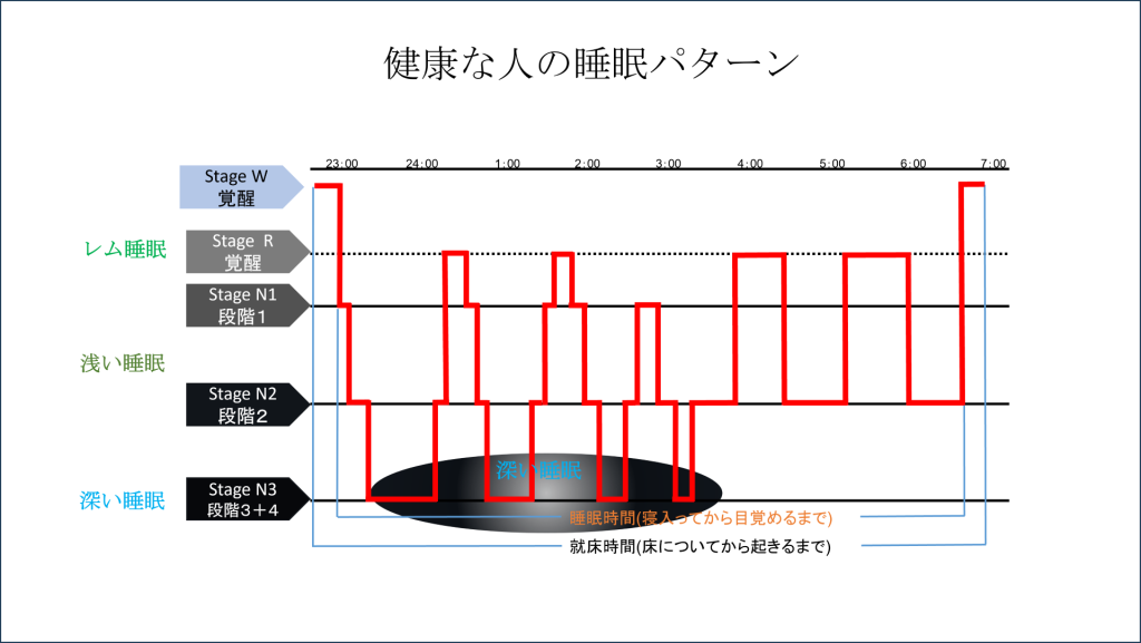 図1:健康な人の睡眠パターン